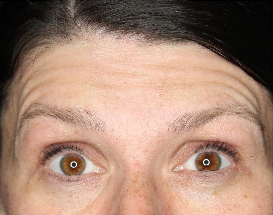 Wrinkle Relaxers
