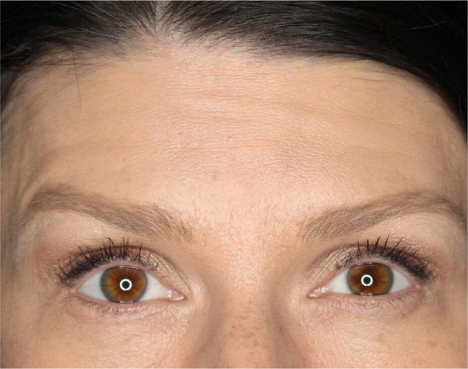 Wrinkle Relaxers