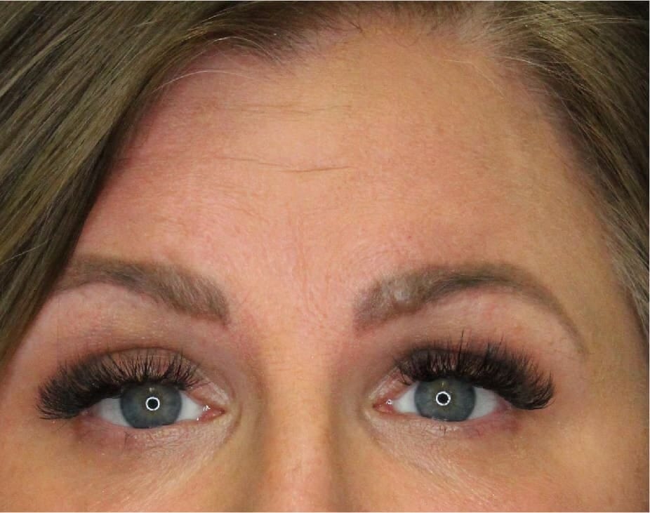 Wrinkle Relaxers