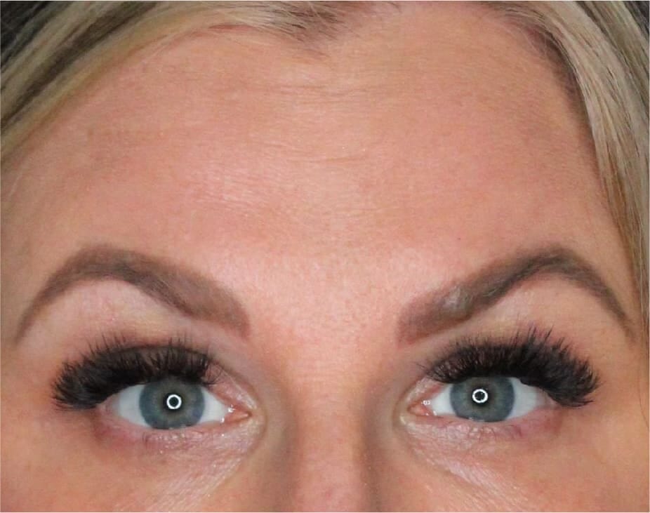 Wrinkle Relaxers