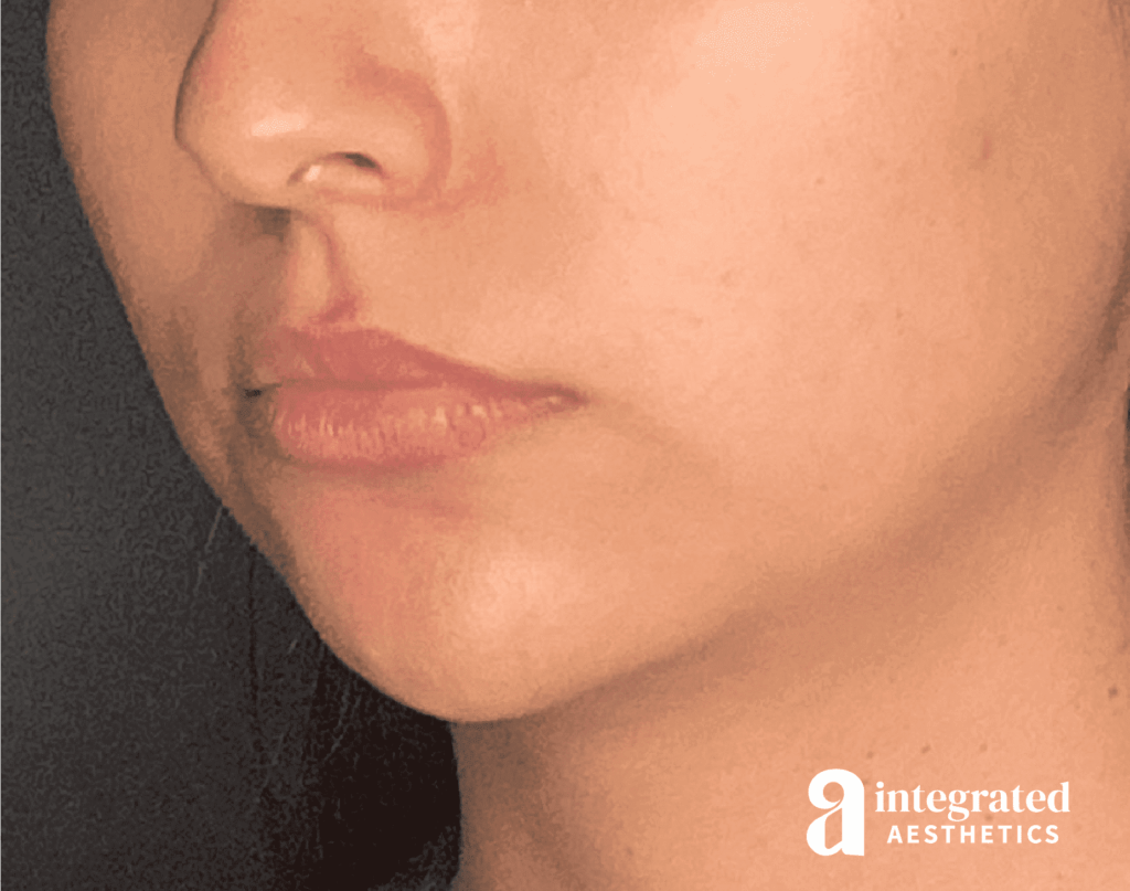 1679417813-beforeandafter15177_web-10.png