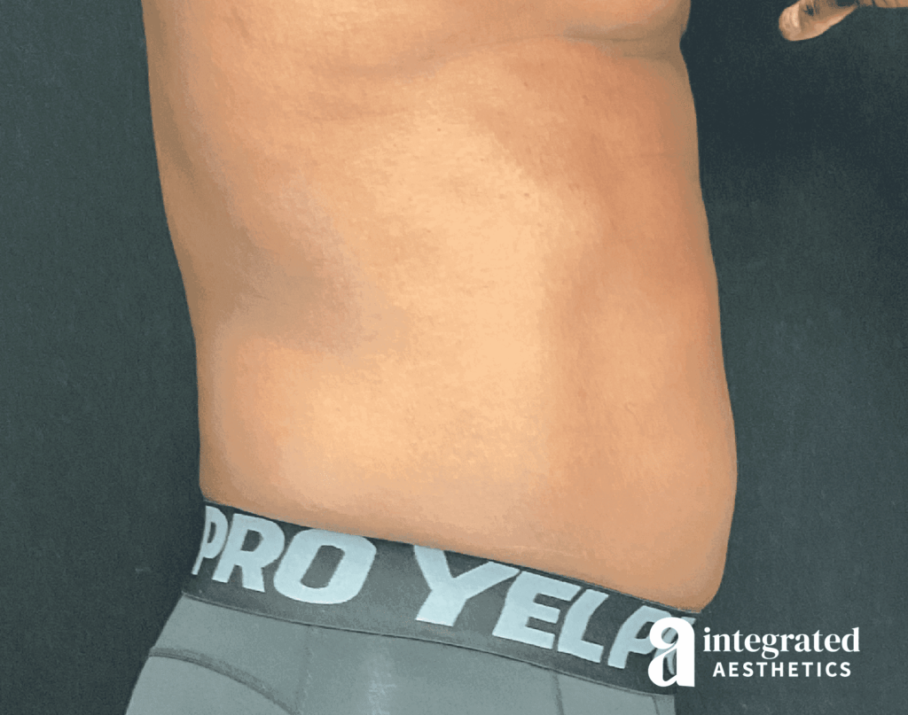 1679418324-22576_after_rightprofile.png