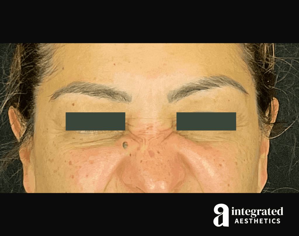 Wrinkle Relaxers