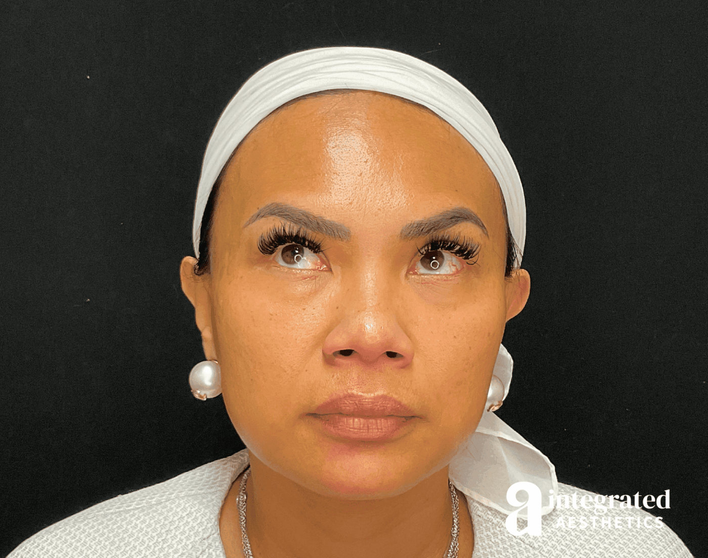 Wrinkle Relaxers