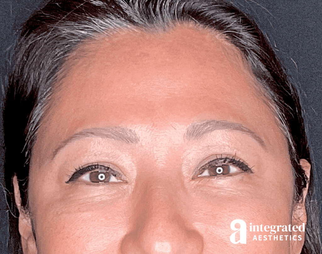 Wrinkle Relaxers