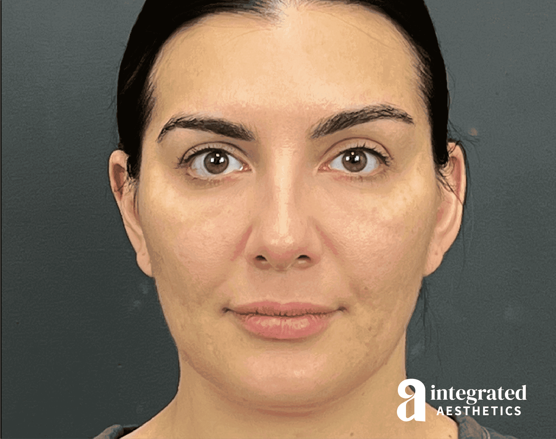Wrinkle Relaxers
