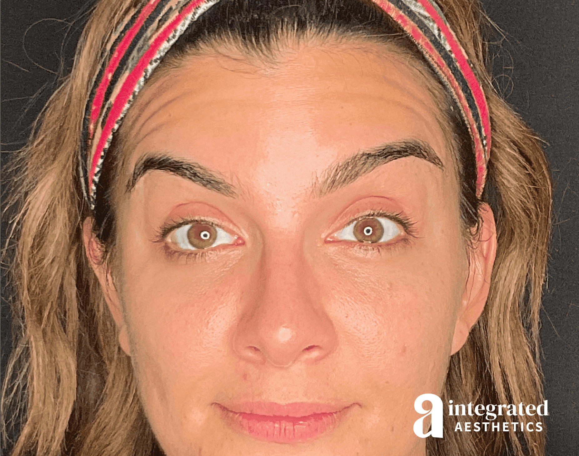 Wrinkle Relaxers