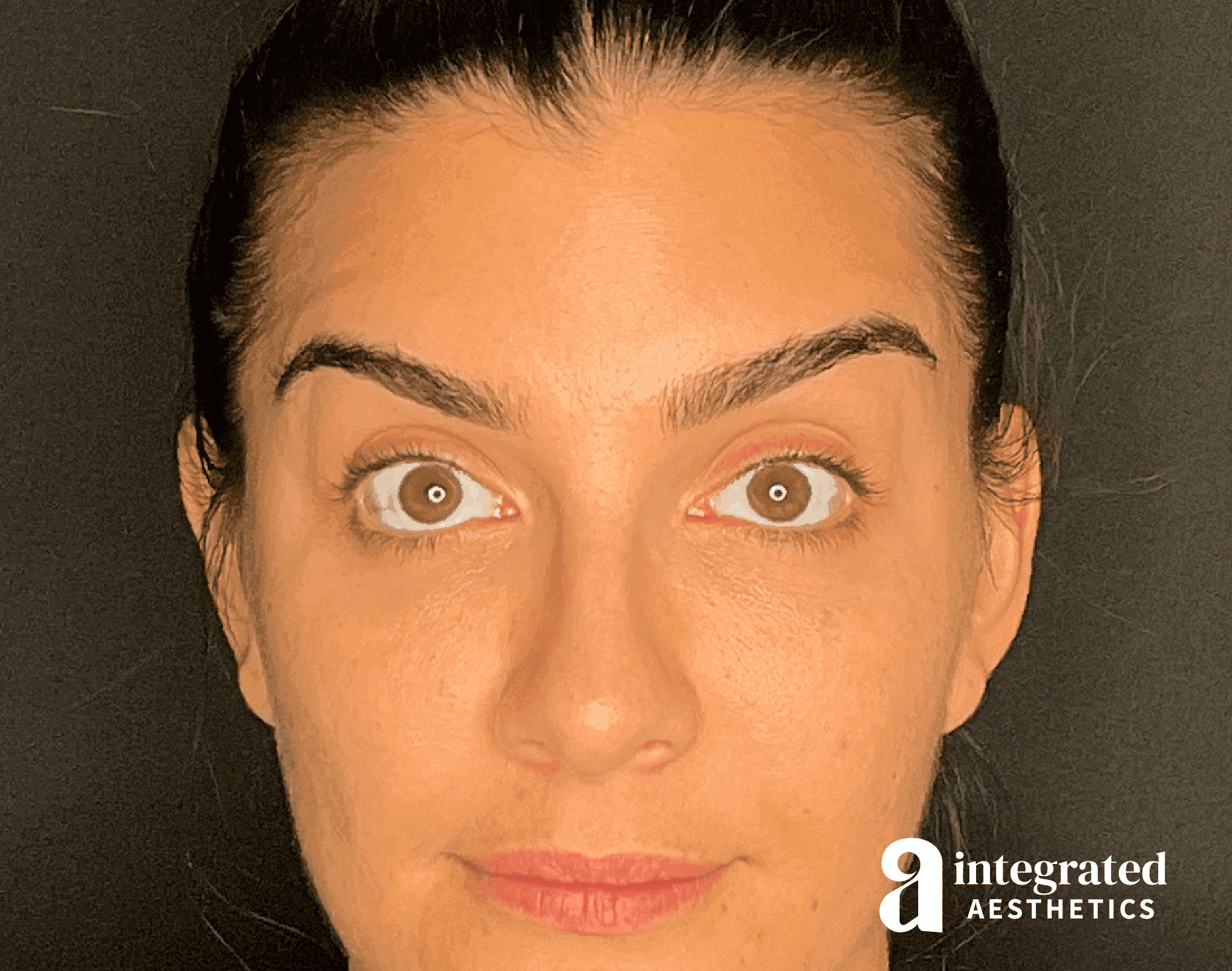 Wrinkle Relaxers