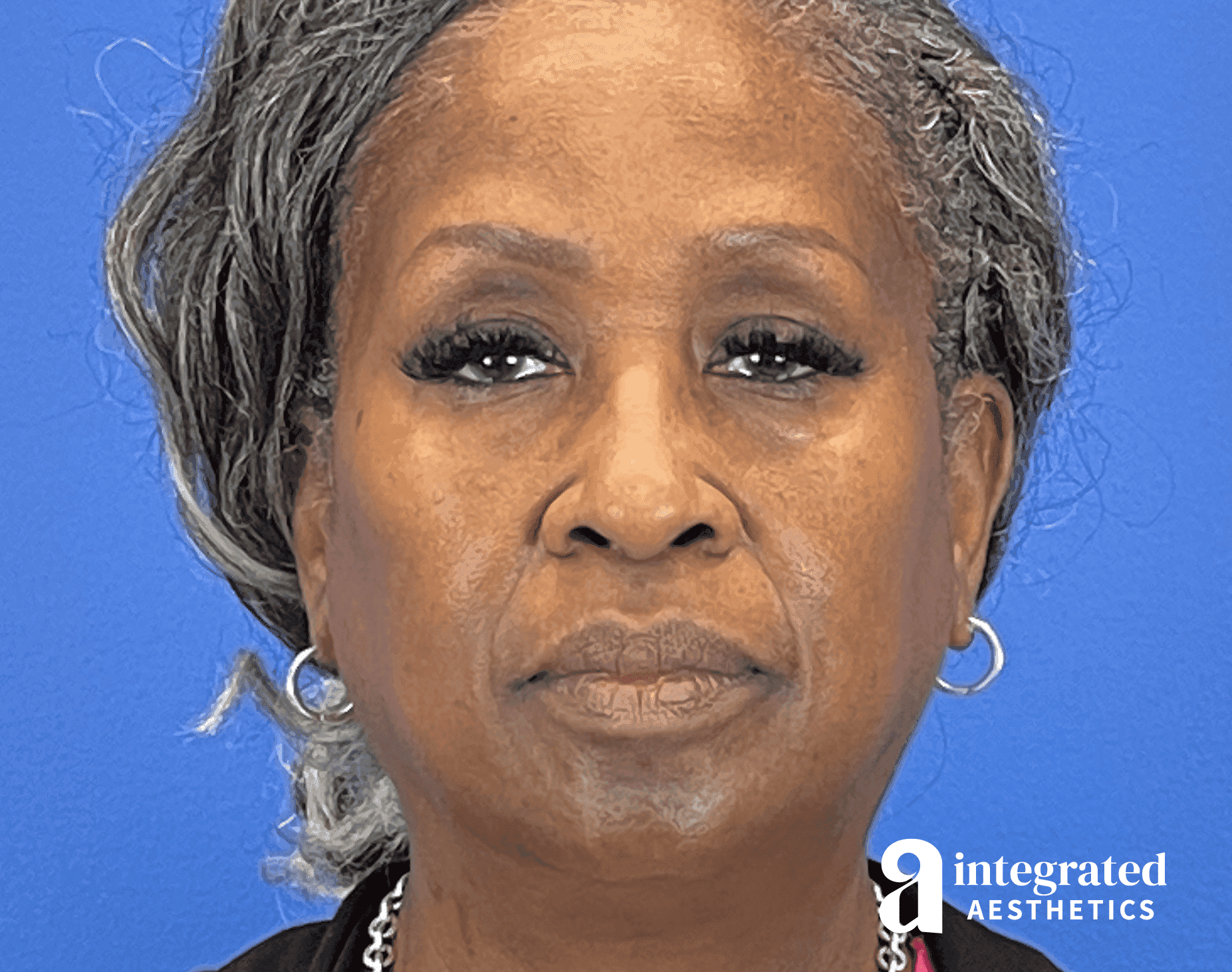 Wrinkle Relaxers