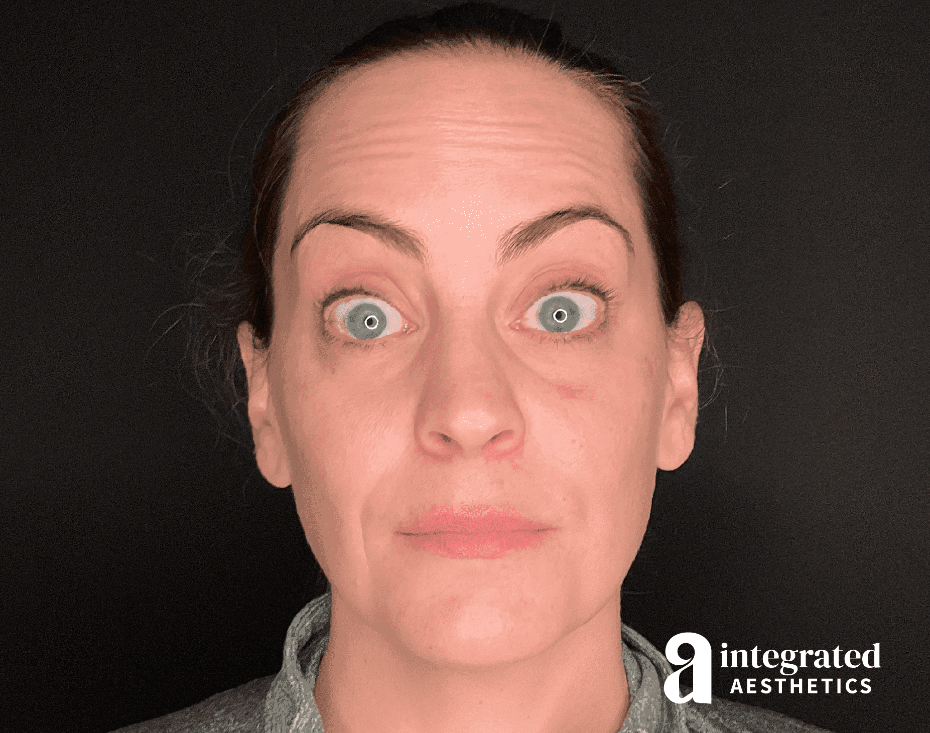 Wrinkle Relaxers