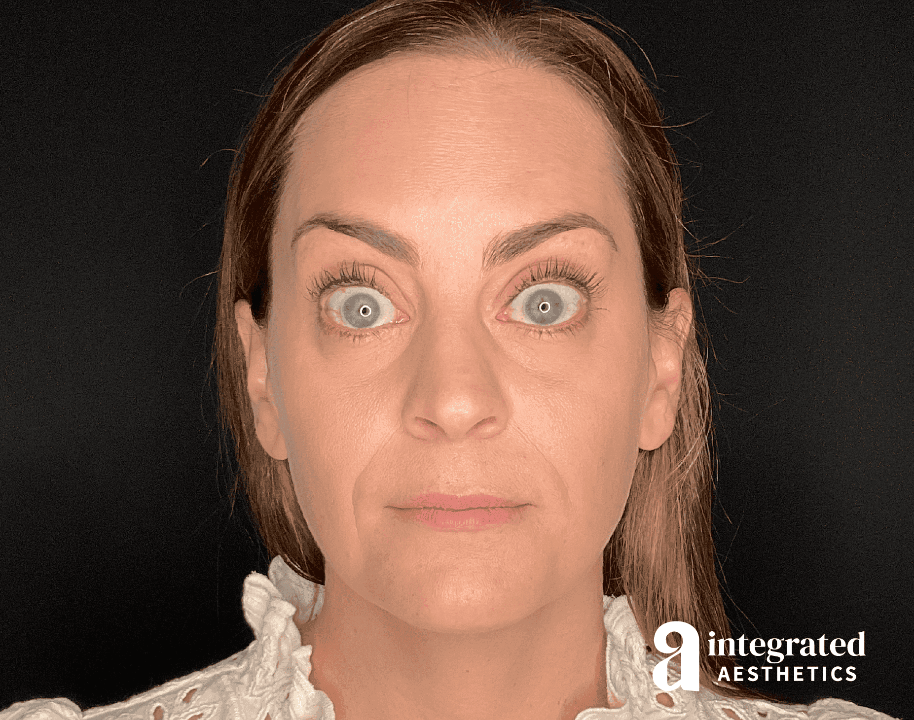 Wrinkle Relaxers