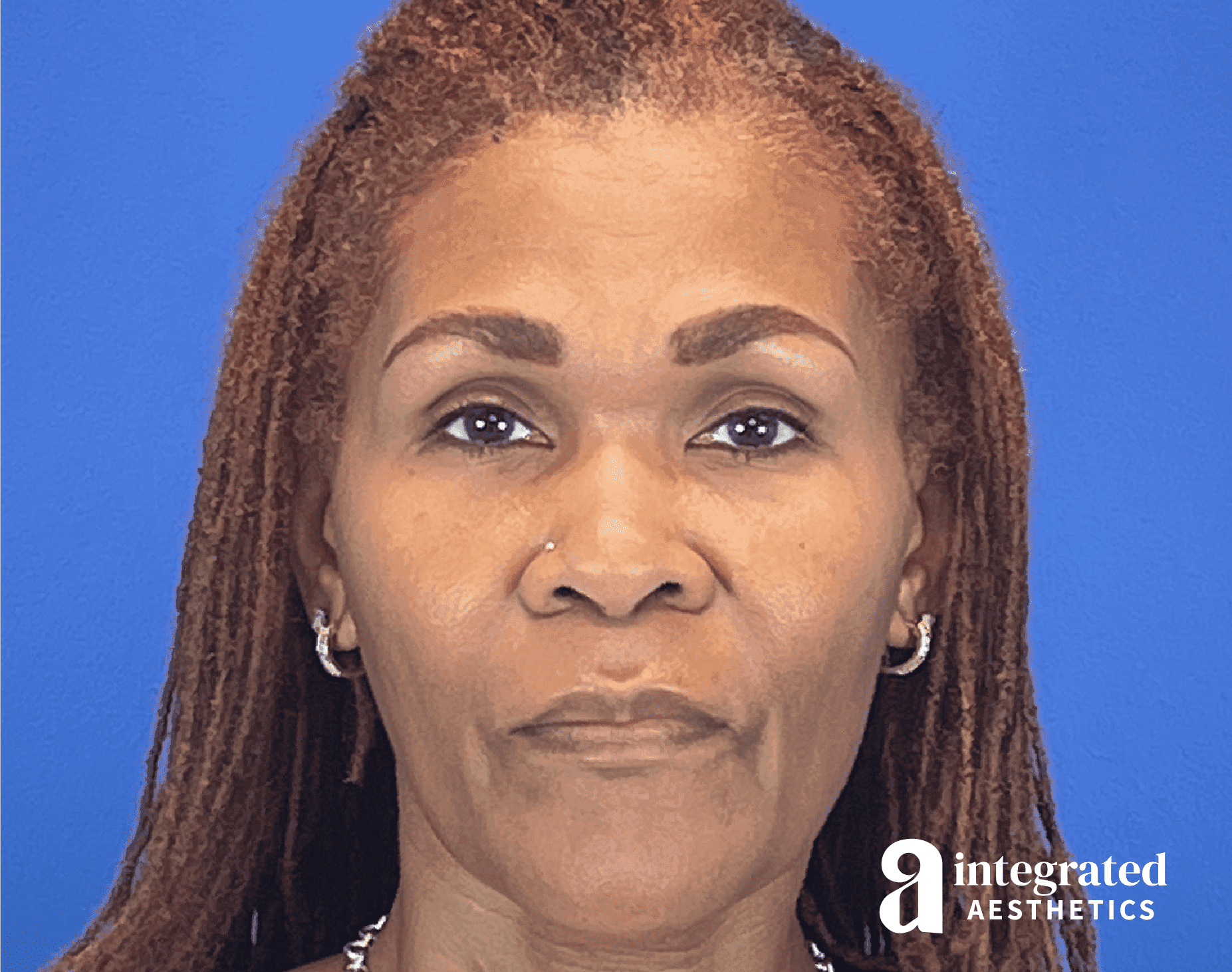 1722290692-beforeandafter27853-13.png