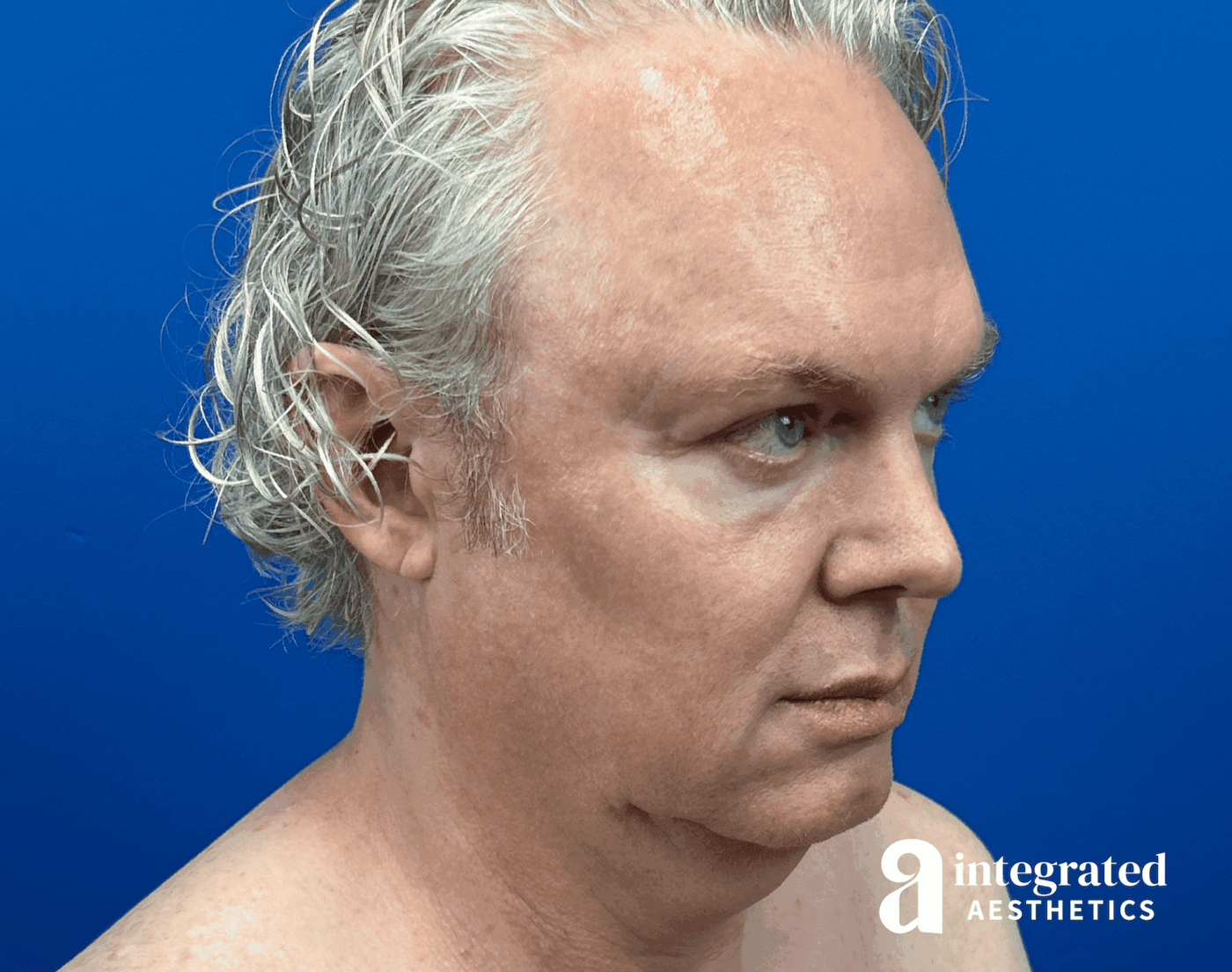 1723842782-beforeandafter09126-12.png