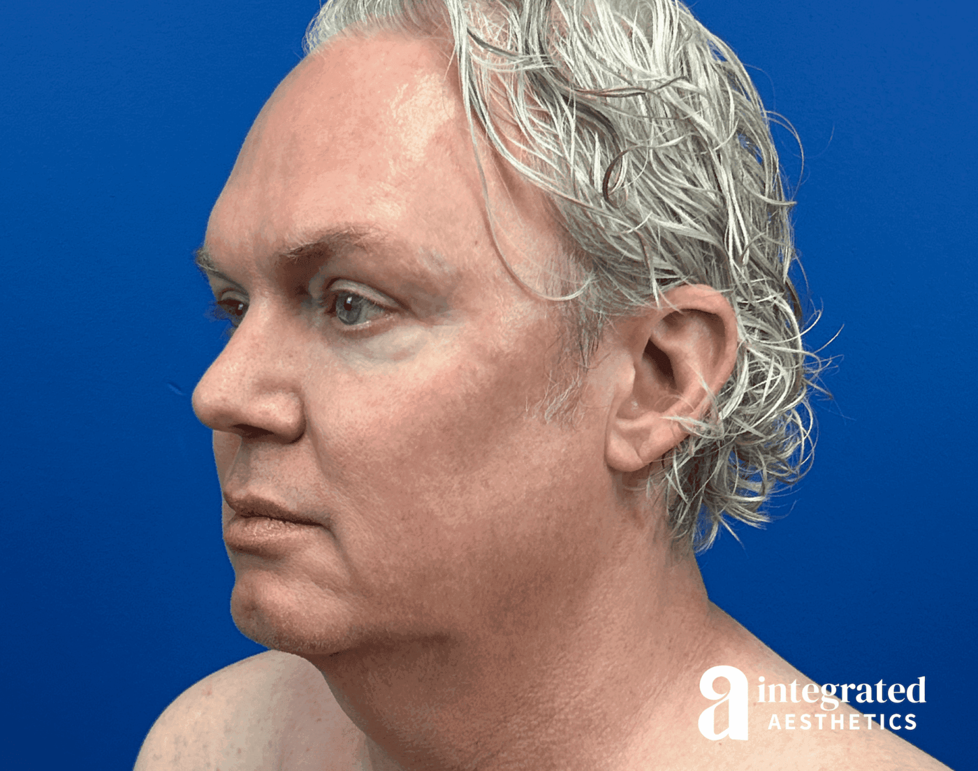 1723842850-beforeandafter09126-14.png