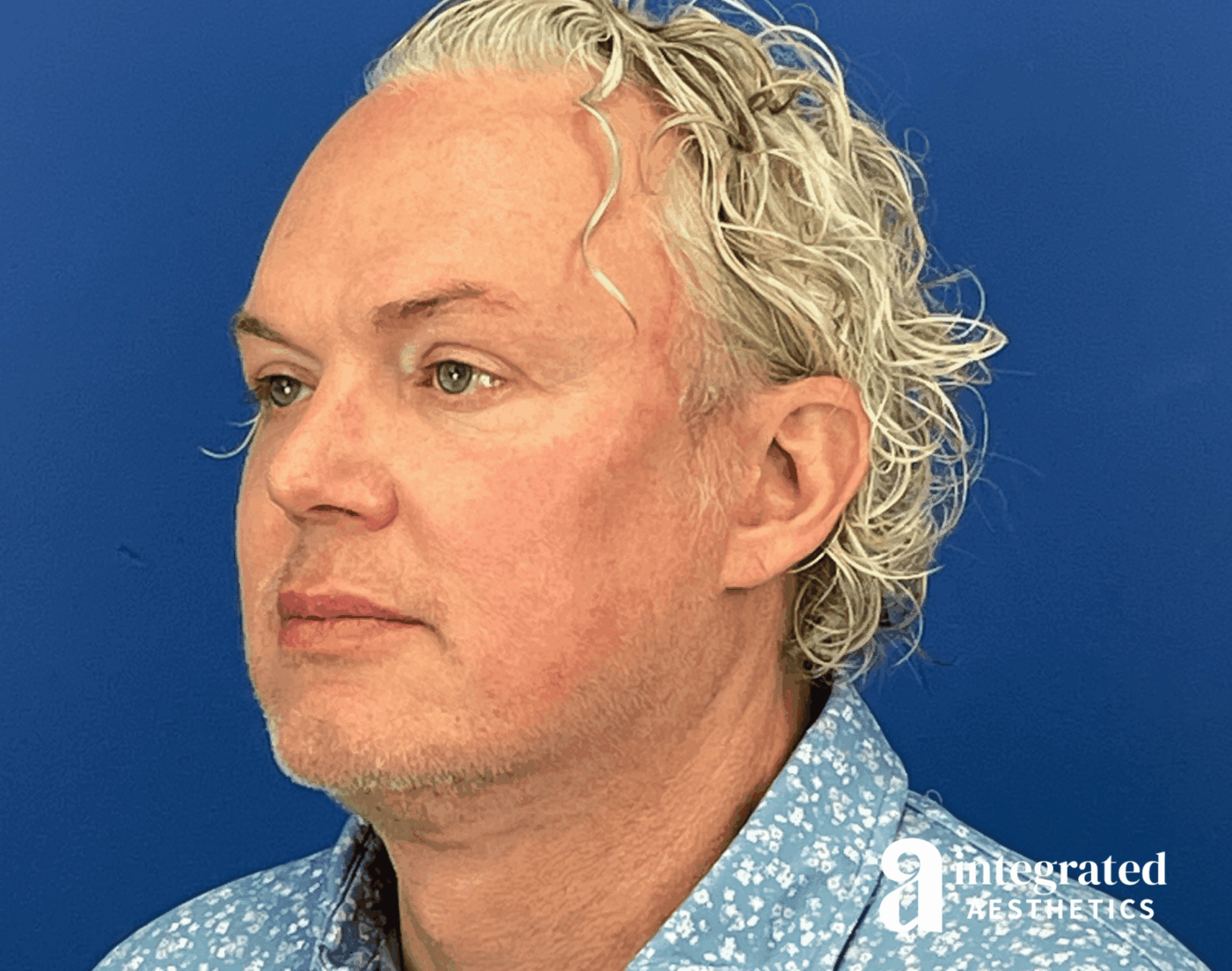 1723842882-beforeandafter09126-15.png