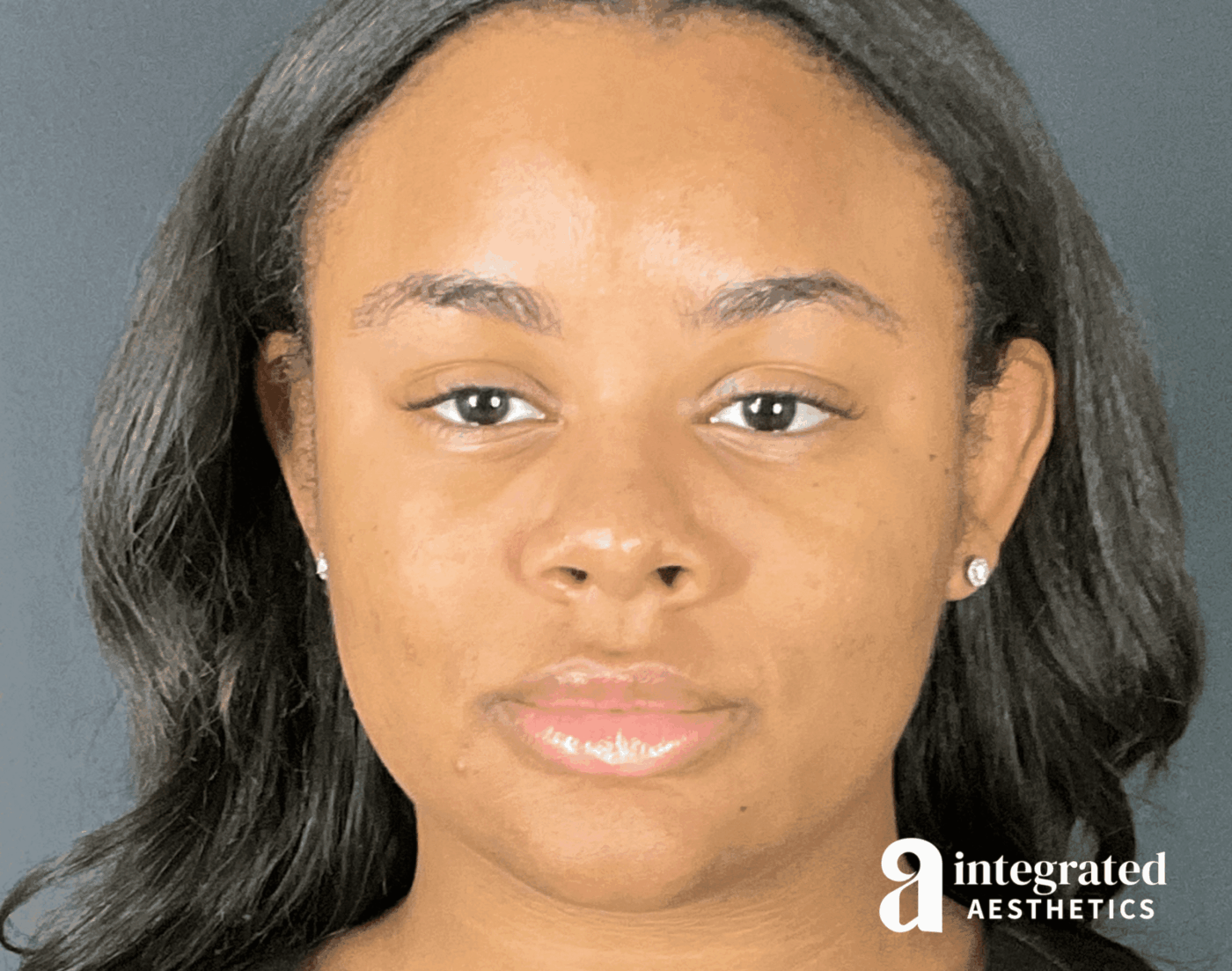 Wrinkle Relaxers