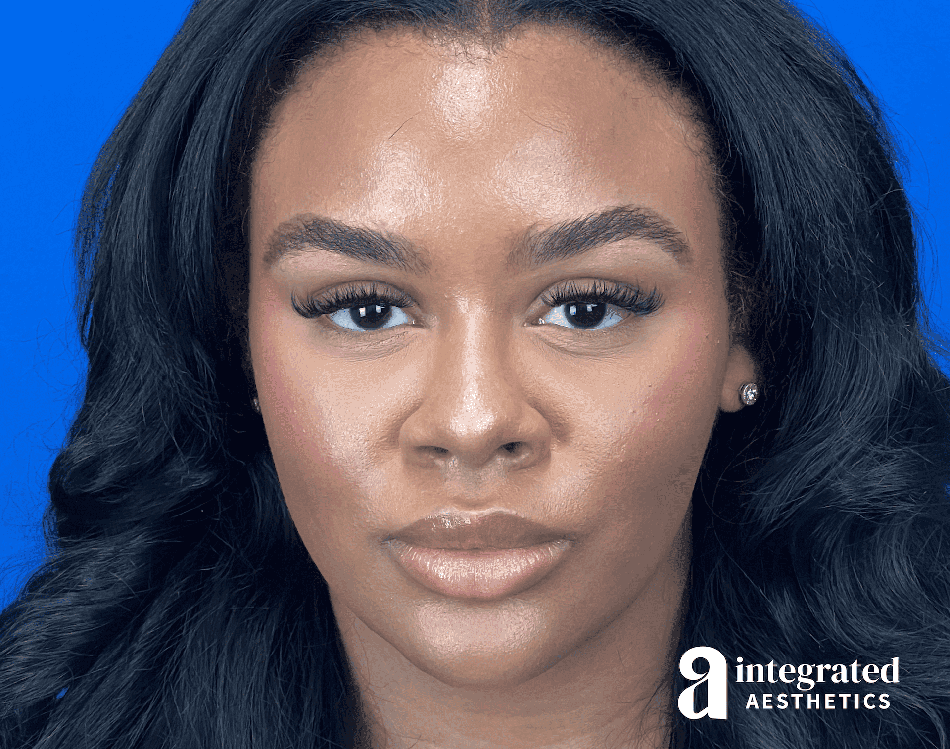 Wrinkle Relaxers
