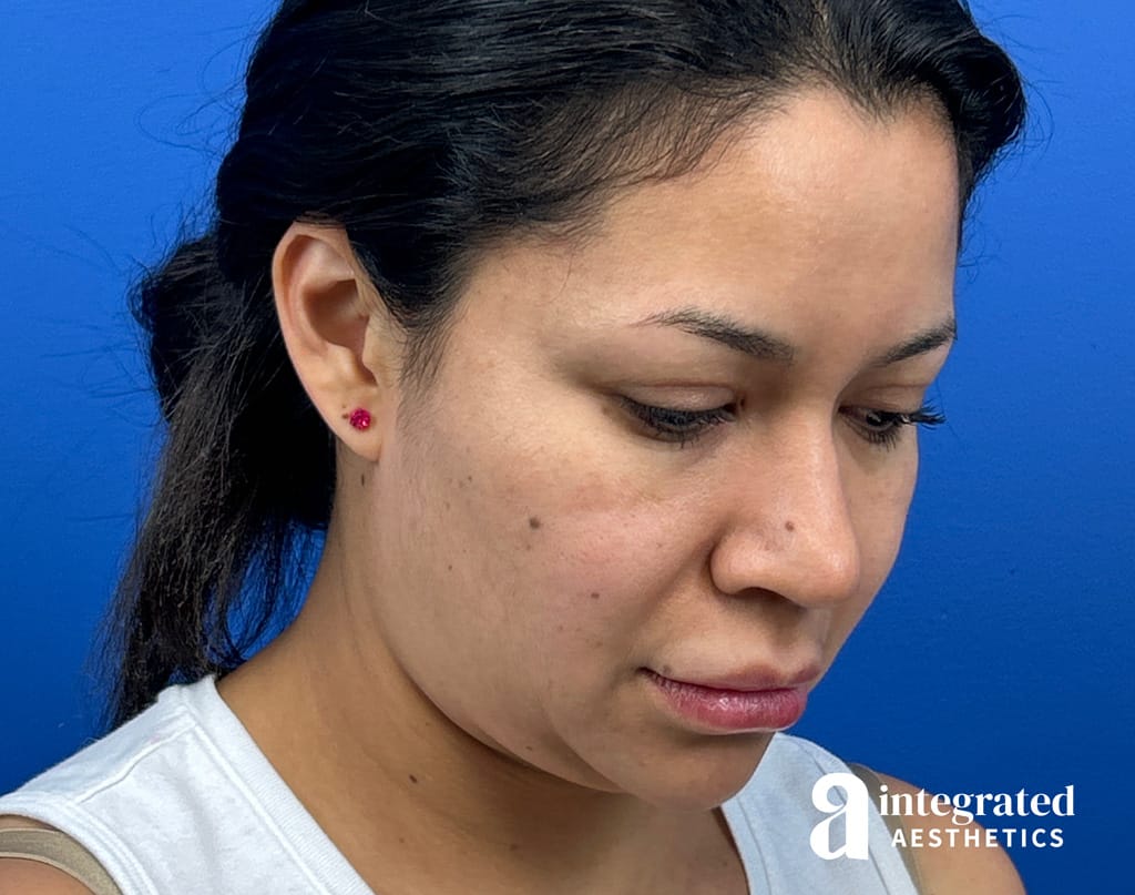 27886-18