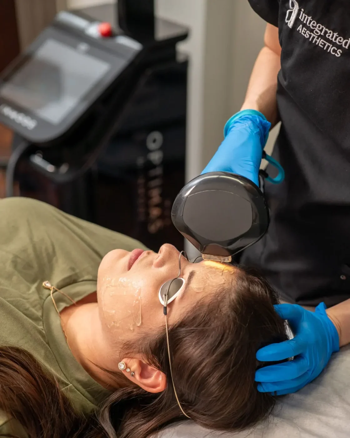Dr. Chiang with InMode Lumecca Peak (IPL) patient procedure