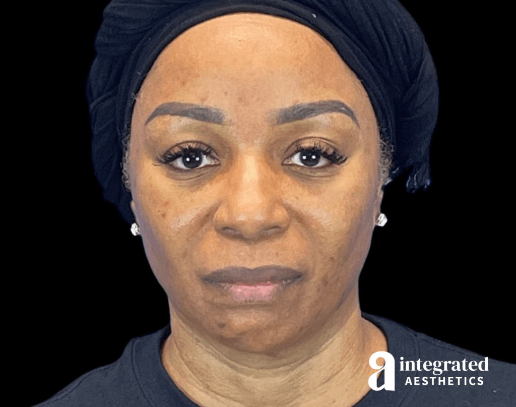Wrinkle Relaxer