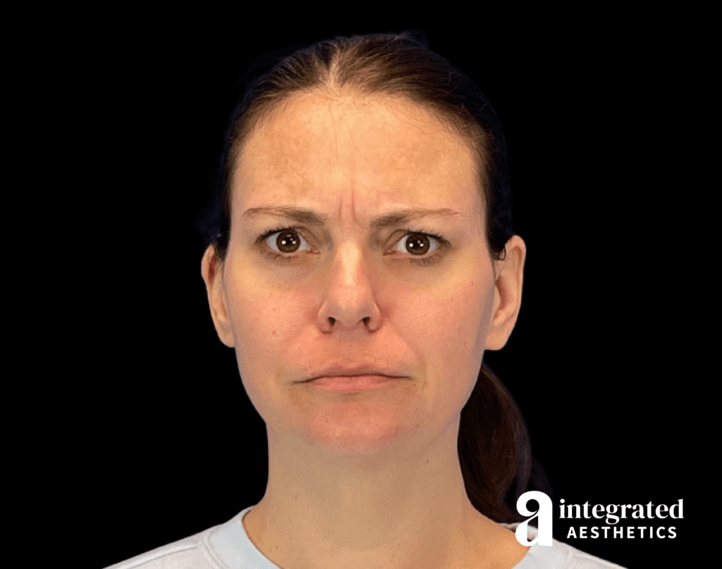 Wrinkle Relaxers
