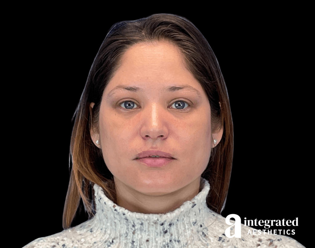 Wrinkle Relaxers