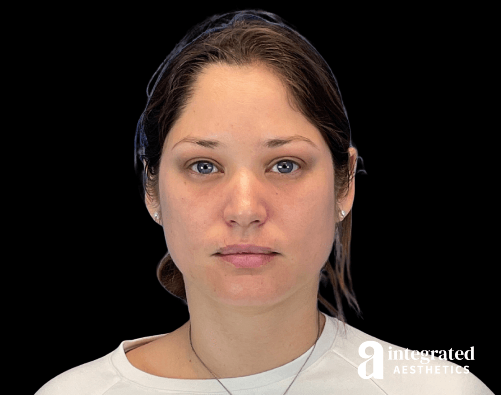 Wrinkle Relaxers